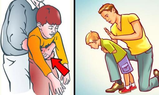 Phải làm sao khi trẻ bị sặc, hóc dị vật?