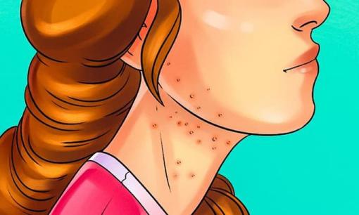 9 dấu hiệu cho thấy bạn đang ăn quá nhiều đường