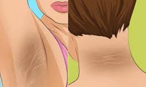 9 triệu chứng ban đầu của bệnh tiểu đường cần nhận biết để chữa trị kịp thời