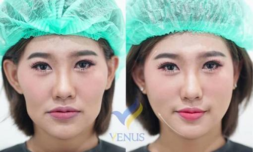 Tái sinh đa tầng dẫn đầu xu hướng làm đẹp của phụ nữ hiện đại