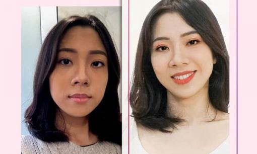 Làm trắng da đúng cách theo chuẩn y khoa cho phái đẹp Việt