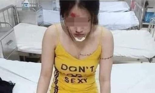 'Lỡ' ngủ với người yêu cũ bị chồng đánh, cô gái lên mạng than: 'Trên đời này còn đàn ông tốt nữa không'