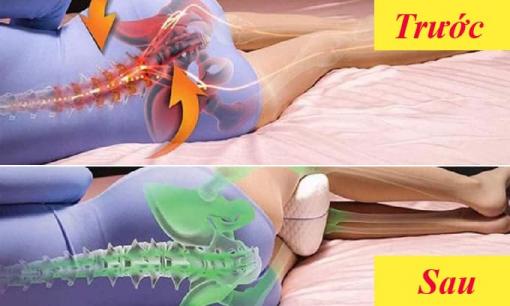 Lợi ích của việc kẹp gối giữa hai chân khi ngủ, thói quen đơn giản nhưng rất tốt cho sức khỏe