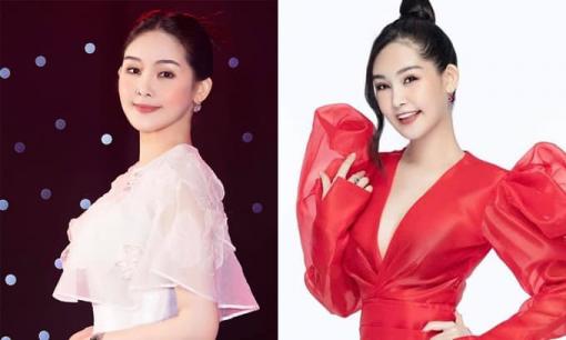 Sau khi bị soi chuyện cười không thấy răng, Lê Âu Ngân Anh đã đến nha khoa để chỉnh sửa điểm kém đẹp