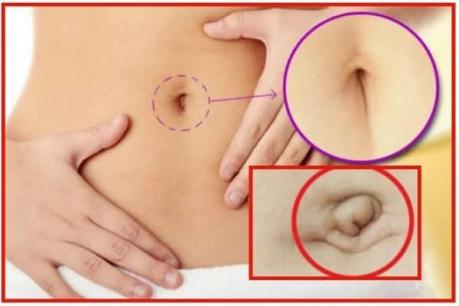Nhìn tướng rốn có thể đoán biết trước được vận mệnh tương lai giàu có hay nghèo khổ