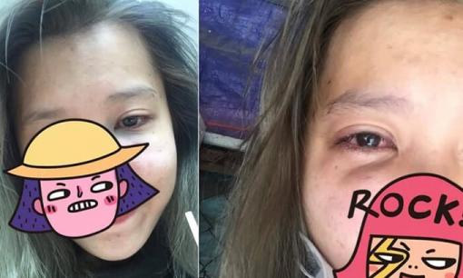 Bóc phốt bị bạn trai đánh, quay lén bạn thân tắm, cô gái tưởng được đồng cảm nhưng không ngờ lại bị chỉ trích