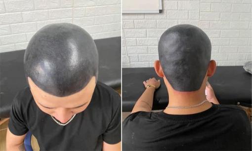 Chàng trai 'chơi lớn' khi xăm tóc lên đầu trọc để lấy vợ