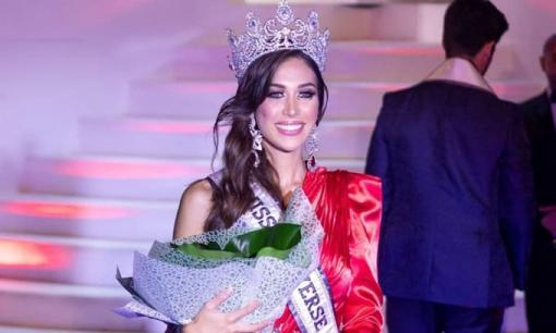 Tân Hoa hậu Hoàn vũ Tây Ban Nha 2020 bị chê già, xấu