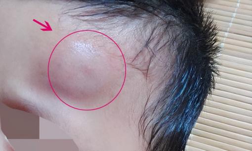 Sau khi con rơi ra khỏi giường, cha mẹ khôn ngoan sẽ không đỡ ngay lập tức. Điều quan trọng là phải hiểu 'mười giây vàng'