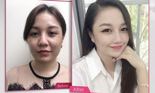 Tái cấu trúc ngoại vi - trẻ hóa và những lưu ý từ các chuyên gia