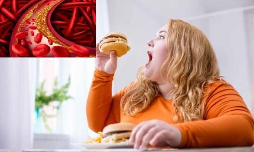 'Đồng phạm' của bệnh mỡ máu là đây! Ăn 3 thứ này, đừng trách sao mỡ máu cao