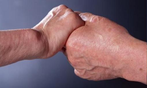 Cách phòng ngừa đột quỵ, hướng dẫn bạn một số phương pháp đơn giản và hiệu quả