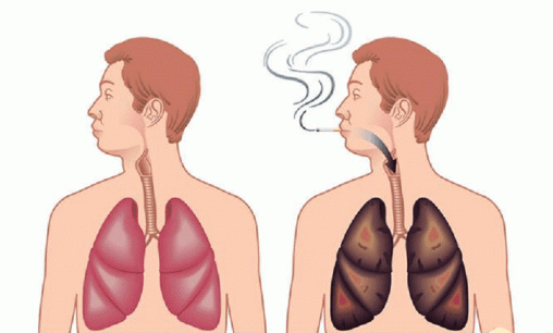 Chậm nhất là bao nhiêu tuổi để bỏ thuốc lá và phổi có thể trở lại bình thường? Bác sĩ: Đừng bỏ lỡ tuổi đẹp nhất