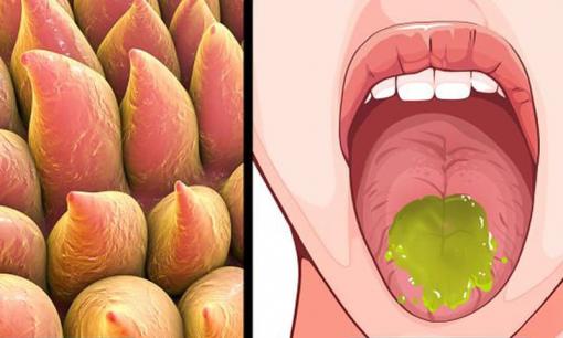 8 cách chữa lành vết bỏng ở lưỡi sau khi ăn đồ cay nóng