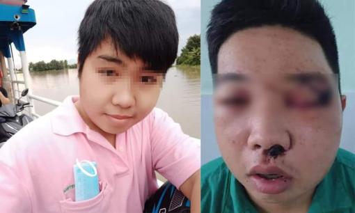 Lộ hình ảnh bầm dập, sưng húp mặt mũi của nam thanh niên Tây Ninh xúc phạm cố NS Chí Tài, nghi do bị đánh?