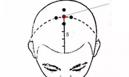 Hãy ghi nhớ 5 điểm này để ngăn ngừa rụng tóc nhé! 