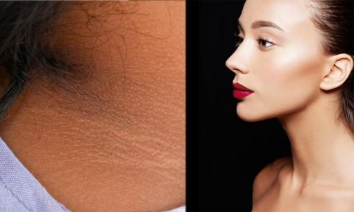 Muốn có vùng da cổ không bị đen lại mịn màng và sạch mụn, đừng bỏ qua 6 bí quyết này