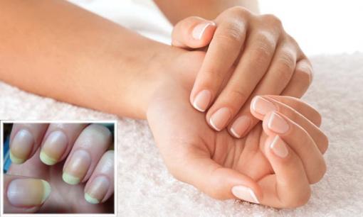 7 mẹo giúp móng tay trắng sạch, đánh bay ố vàng trong vòng 1 nốt nhạc