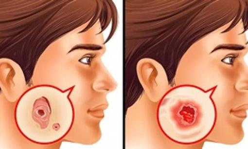 6 xét nghiệm y tế mà người lớn nên làm để phòng tránh các bệnh nguy hiểm 