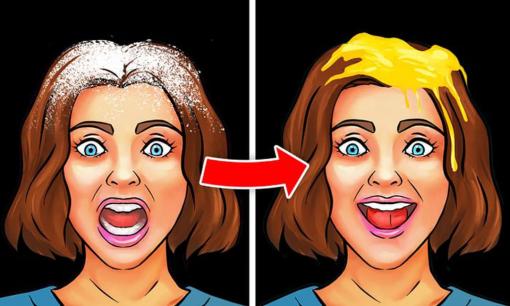 9 thói quen hàng ngày khiến da đầu của bạn nhiều gàu hơn