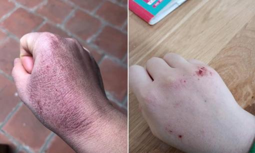 Câu trả lời khi ai hỏi về cái rét 'cắt da cắt thịt' ở miền Bắc là thế nào