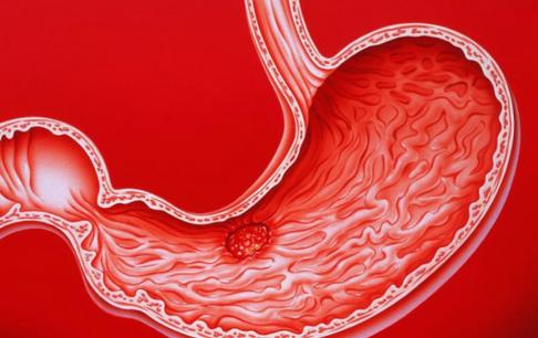 Người bị bệnh dạ dày thường ăn thực phẩm này để bồi bổ và bảo vệ dạ dày, dạ dày ngày một khỏe hơn