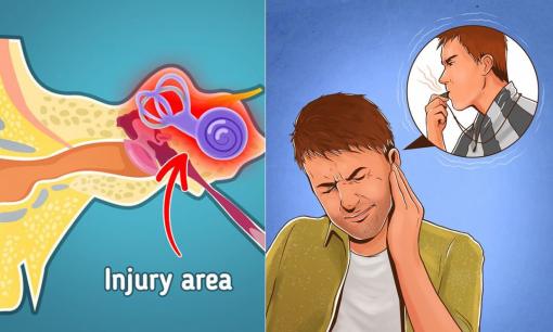 Lý do tại sao thỉnh thoảng chúng ta lại thấy 'ù ù' trong tai và cách khắc phục