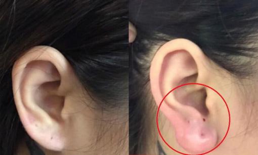 Nữ doanh nhân vào spa làm 'tai Phật' để cải thiện tướng số, đổi vận đâu chưa thấy đã nhận lấy 'trái đắng'