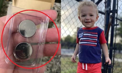 Cậu bé 2 tuổi qua đời sau khi nuốt phải cục pin cúc áo và bị 'đốt cháy' nội tạng