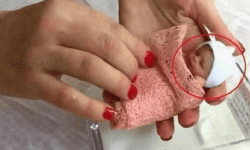 'Em bé nhỏ nhất thế giới' khi sinh ra chỉ dài 25 cm, nhưng hiện tại đã 15 tuổi