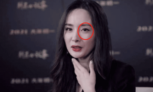 Lộ vết lạ trên mặt, Dương Mịch khiến cư dân mạng đặt nghi vấn phẫu thuật thẩm mỹ