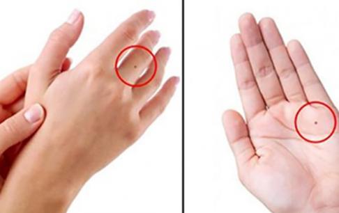 Vị trí nốt ruồi ở lòng bàn tay cho biết vận mệnh tương lai của bạn giàu sang quý quý hay túng thiếu?