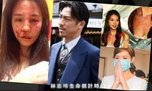 Rộ tin Lâm Chí Linh bị chồng bạo hành và sống ly thân vì không thể mang thai