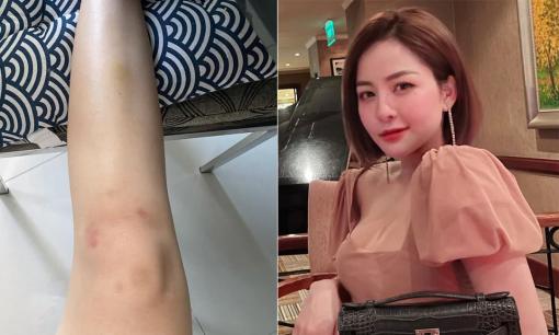 Bị dân mạng soi đầu gối thâm nghi liên quan đến chuyện nhạy cảm, hot girl Trâm Anh lên tiếng