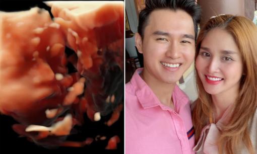 Thảo Trang đăng ảnh siêu âm thai, tiết lộ đặc điểm gen trội nhìn qua là ưng
