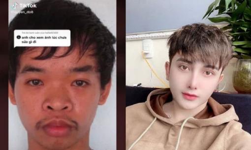 Hot boy Hưng Yên 'đập mặt xây lại' 20 lần khiến bố mẹ ruột cũng không nhận ra