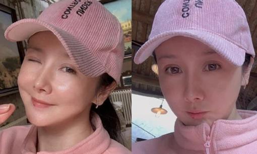 Không còn nhận ra 'Đệ nhất mỹ nhân cổ trang' Tôn Phi Phi một thời, giờ gương mặt cứng đơ do di chứng thẩm mỹ 