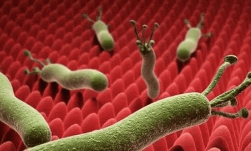 Có một khối u trong ruột, cơ thể sẽ phát ra 3 tín hiệu, nếu có, hãy làm nội soi