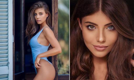 Tân Hoa hậu Ba Lan: Người đẹp hiếm hoi có đôi mắt tự nhiên mang 2 màu khác biệt