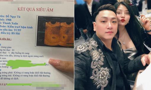 Sau drama bị vợ tố công khai ngoại tình, diễn viên Phùng Cường khoe tình mới đã mang bầu 