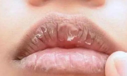 Khô miệng khi ngủ có thể là tín hiệu xấu về sức khỏe, đừng vội bỏ qua 