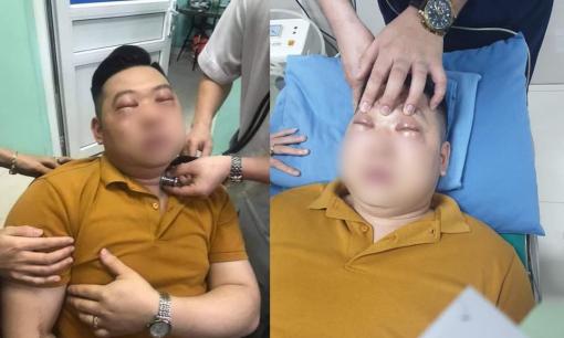 Nam thanh niên bị sốc phản vệ khi thái một củ hành, cả mặt sưng húp, hai mắt không thể mở ra 