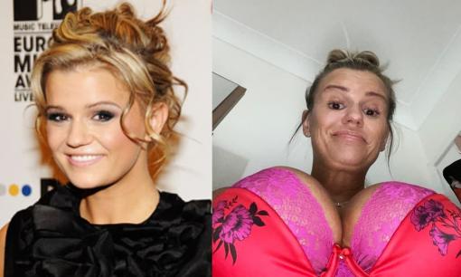 Sao truyền hình Anh và bi kịch nghiện thẩm mỹ: Mặc cảm vì vòng một sau sinh, 'đại tu' để rồi đau khổ vì trở thành 'quái vật ba đầu'