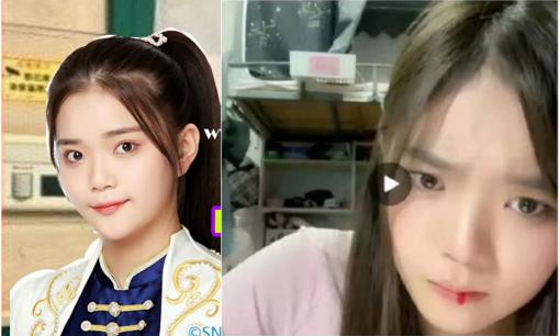 Đang livestream, nữ ca sĩ 20 tuổi của Trung Quốc bị nôn ra máu khiến fan hoảng hốt