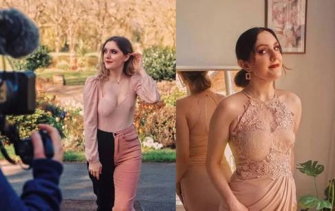 Cô gái 23 tuổi ở Anh mắc căn bệnh ngực lệch hiếm gặp