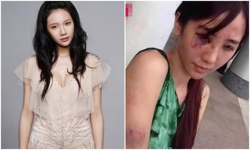 Cô ra mắt năm 18 tuổi để trả nợ cho cha, bị chồng bạo hành trong khi mang thai, cuối cùng chết vì bệnh ung thư ở tuổi 27