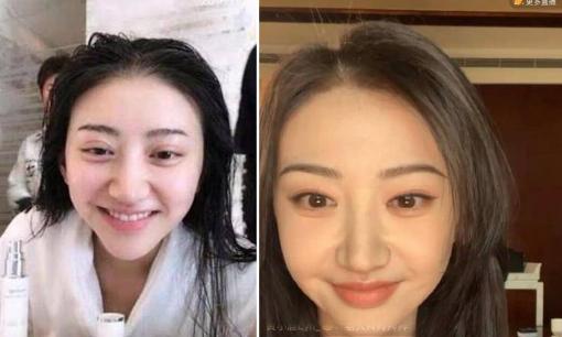 'Đệ nhất mỹ nhân Bắc Kinh' Cảnh Điềm gây sốc với gương mặt khác lạ, cư dân mạng nghi do di chứng của thẩm mỹ hỏng 