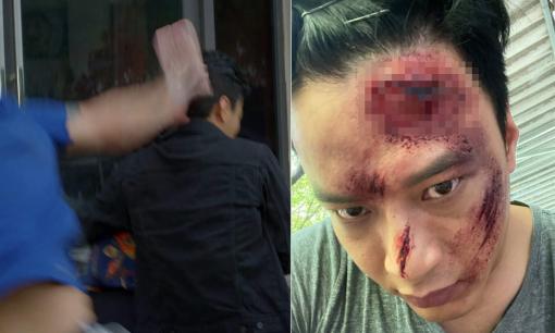 Gần hết 'Hướng dương ngược nắng', Hồng Đăng tổng kết Kiên là vai thê thảm nhất trong 17 năm làm nghề, nhìn ai cũng xót