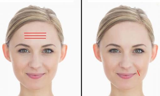 Nhìn nếp nhăn trên mặt để biết bệnh trong cơ thể, hãy đến trung tâm y tế kiểm tra nếu có ở những vị trí này