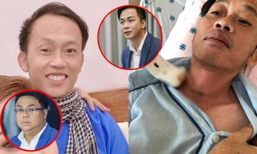 Loạt sao Việt xúc động khi hay tin NSƯT Hoài Linh phẫu thuật u ác tuyến giáp cách đây vài tháng